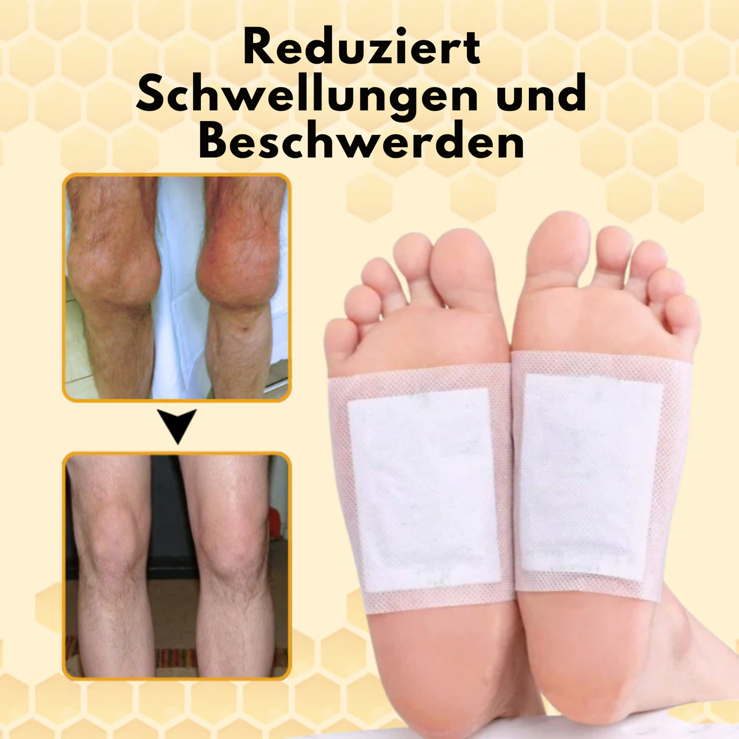 FlexPatch™ | Befreien Sie sich von Gelenkschmerzen!