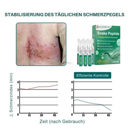 PeptideRelief™ | Beende Nervenqualen in 7 Tagen!