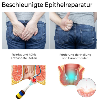 HemReliefSpray™ | 95 % Linderung von intensiven Beschwerden!