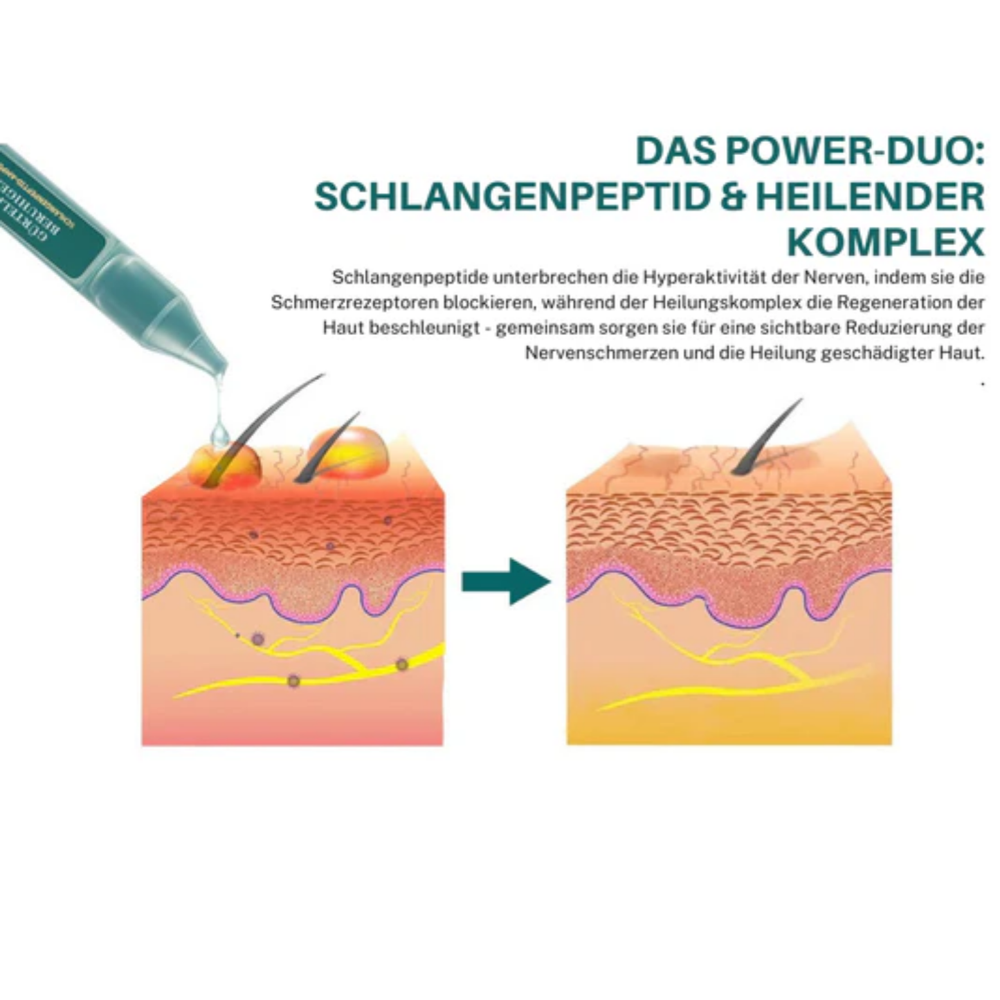 PeptideRelief™ | Beende Nervenqualen in 7 Tagen!