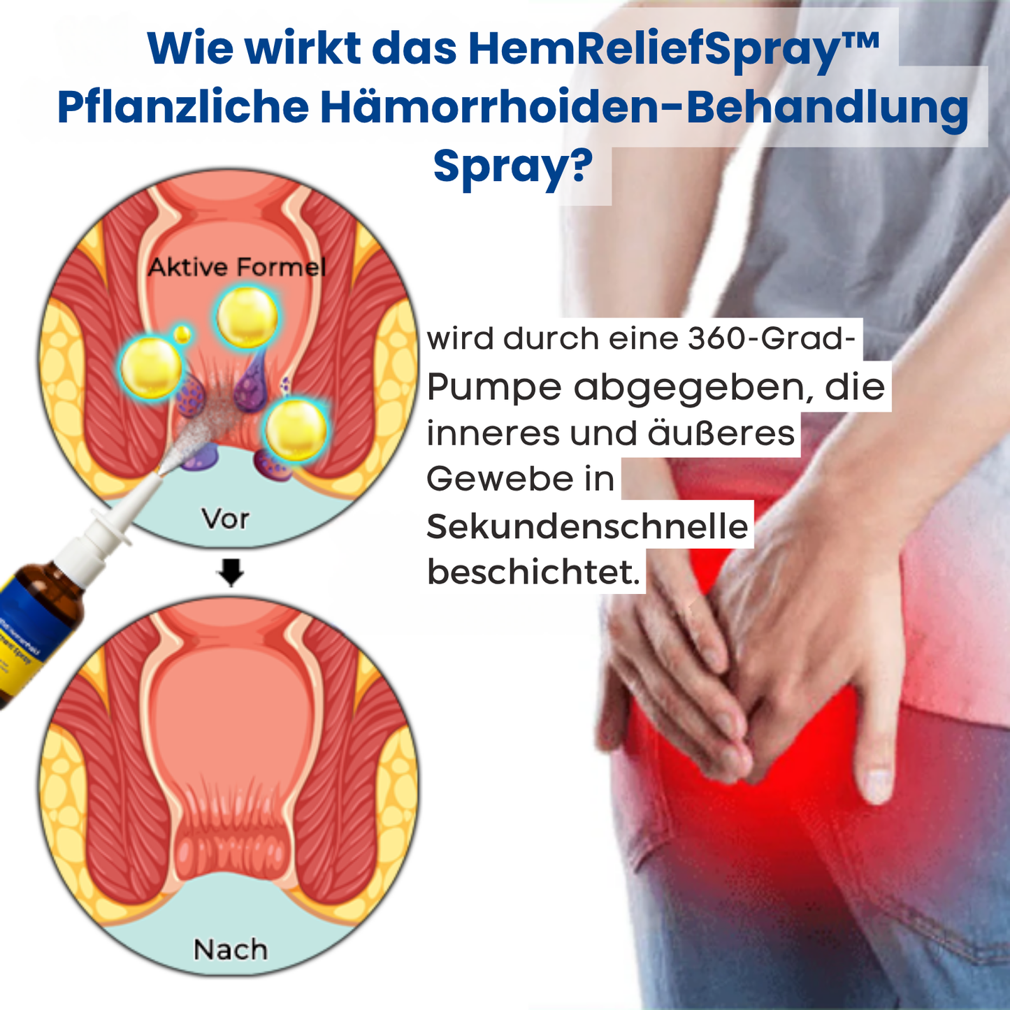 HemReliefSpray™ | 95 % Linderung von intensiven Beschwerden!