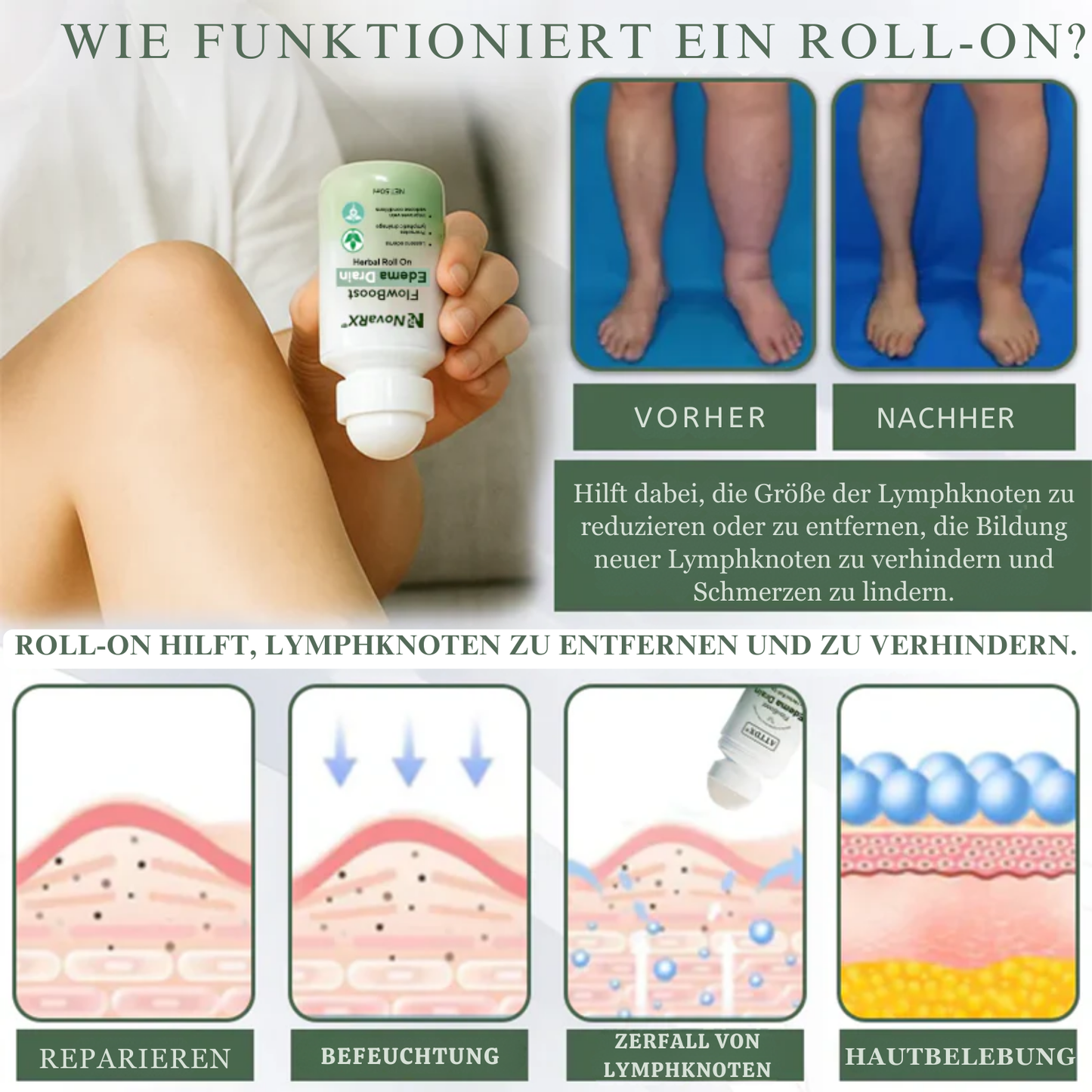 EdemaEase™ | Verabschiede dich noch heute von Schwellungen!