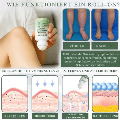 EdemaEase™ | Verabschiede dich noch heute von Schwellungen!