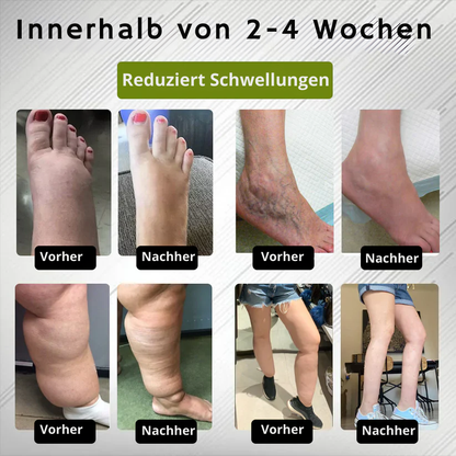 LinderSchritt™ | Besiege Fußschmerzen jetzt