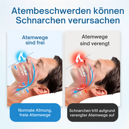 SnoreRelief™ | Schenke dir Ruhe, Wach auf Erfrischt!