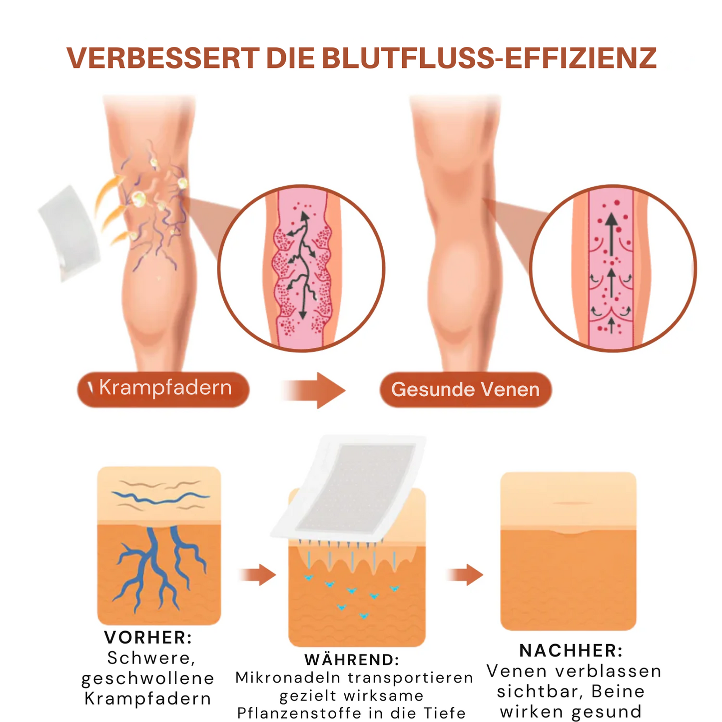 VeinTarget™ | 95 % Linderung – Sichtbare Venenveränderung