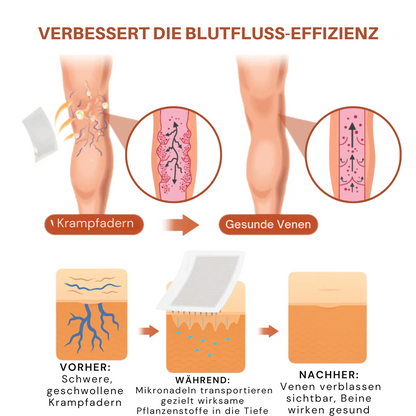 VeinTarget™ | 95 % Linderung – Sichtbare Venenveränderung