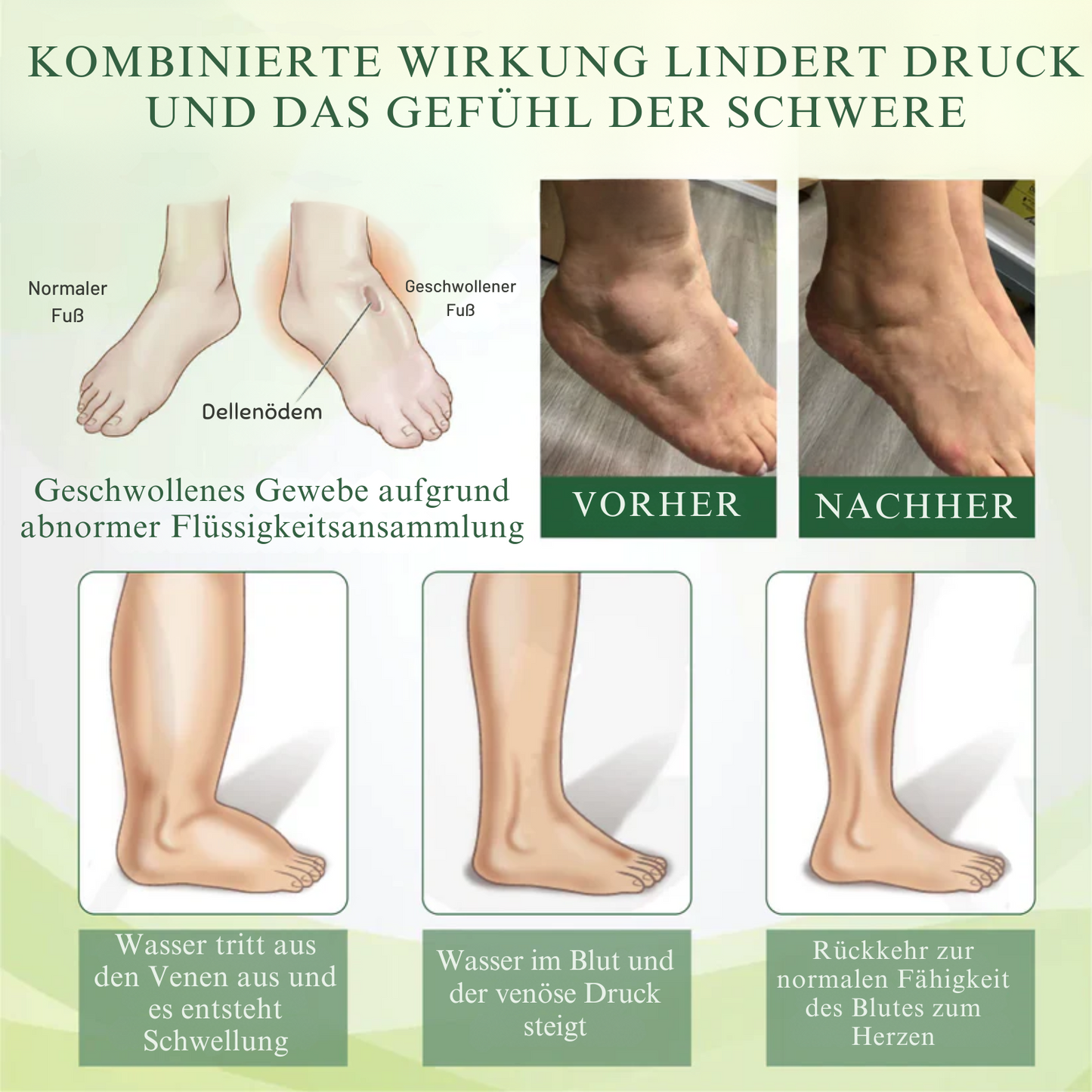 EdemaEase™ | Verabschiede dich noch heute von Schwellungen!