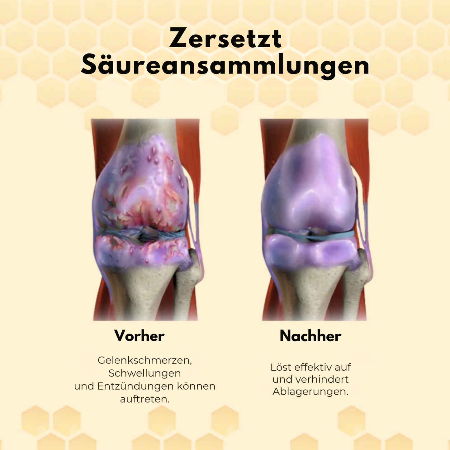FlexPatch™ | Befreien Sie sich von Gelenkschmerzen!