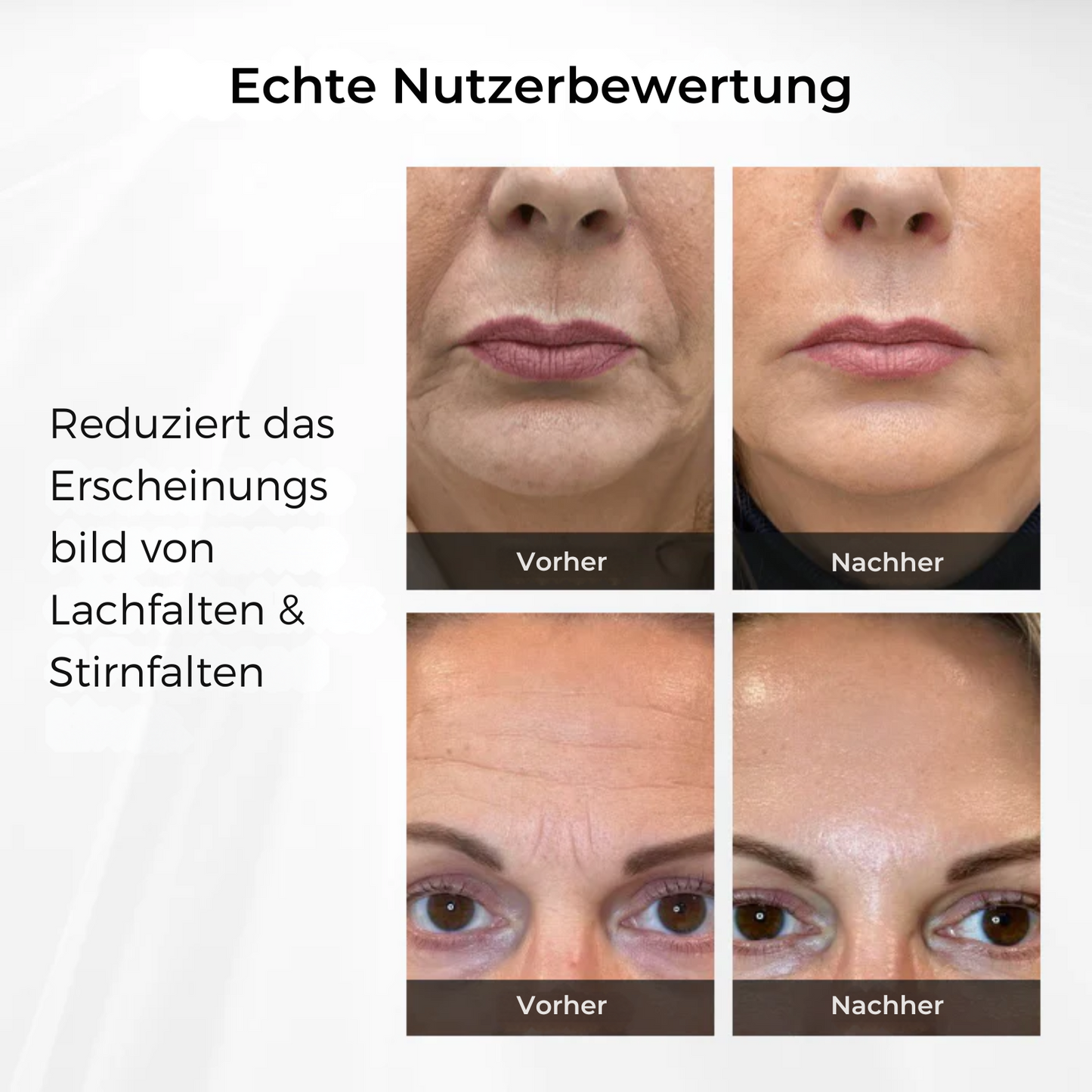 SmoothBright™ | Jugendliche Augen in 90 Sekunden!