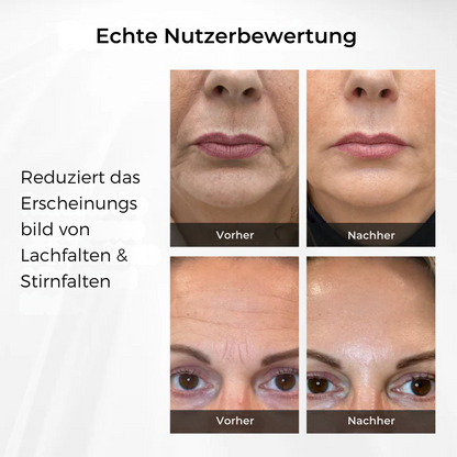 SmoothBright™ | Jugendliche Augen in 90 Sekunden!