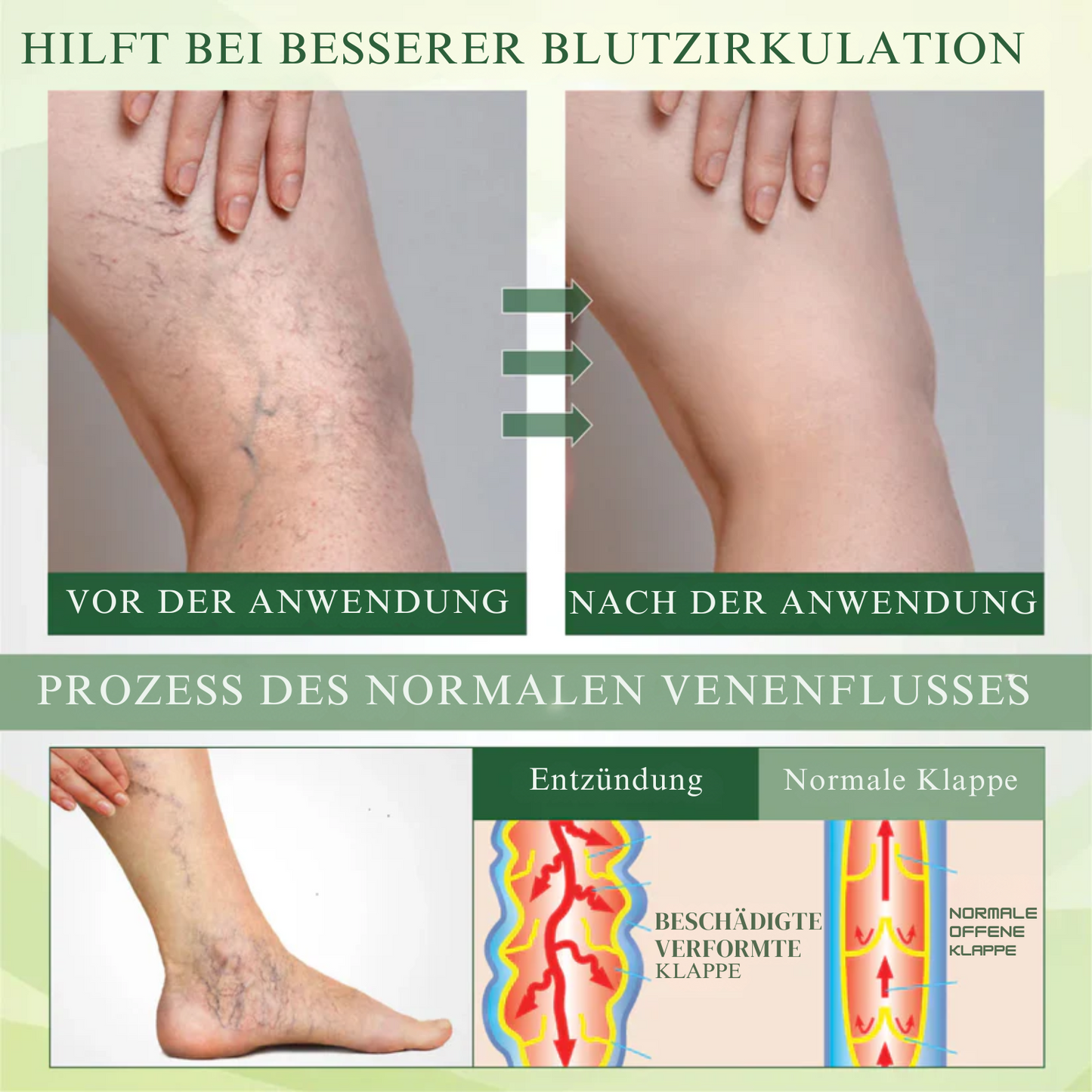 EdemaEase™ | Verabschiede dich noch heute von Schwellungen!