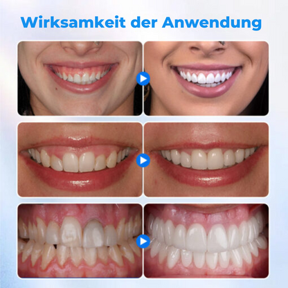 ZahnfleischVital™ | Baut zurückgehendes Zahnfleisch!