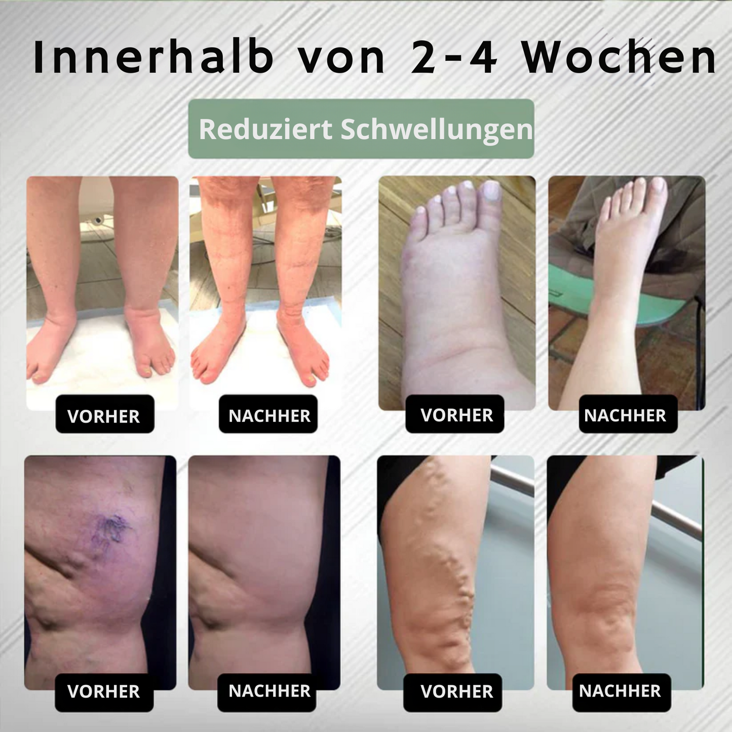 EdemaEase™ | Verabschiede dich noch heute von Schwellungen!