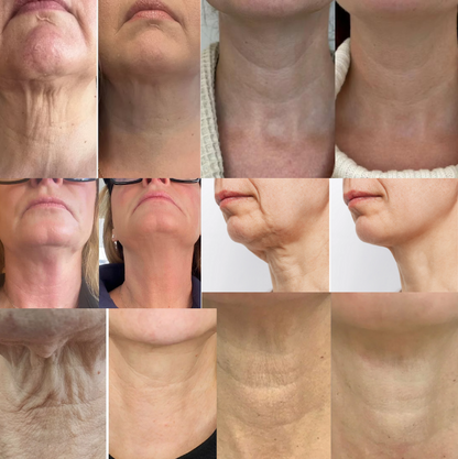FirmNeck™ | Straffe und hebe deinen Hals in nur 7 Tagen!
