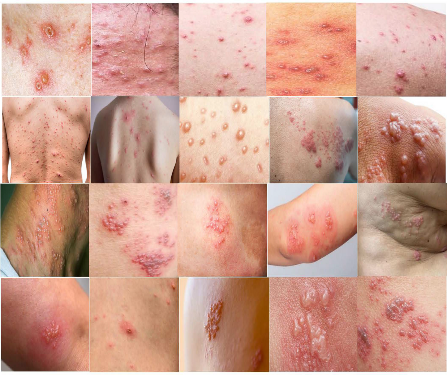 PeptideRelief™ | Beende Nervenqualen in 7 Tagen!
