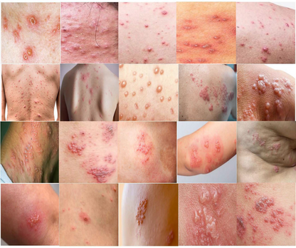 PeptideRelief™ | Beende Nervenqualen in 7 Tagen!
