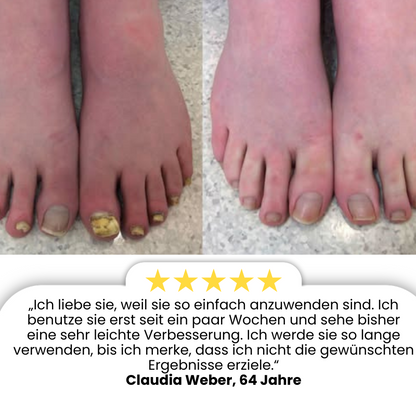 FungiPatch™ Stellen Sie gesunde Nägel ganz einfach wieder her