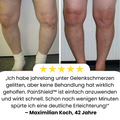 PainShield™ | 95 % Entzündung in 7 Tagen!