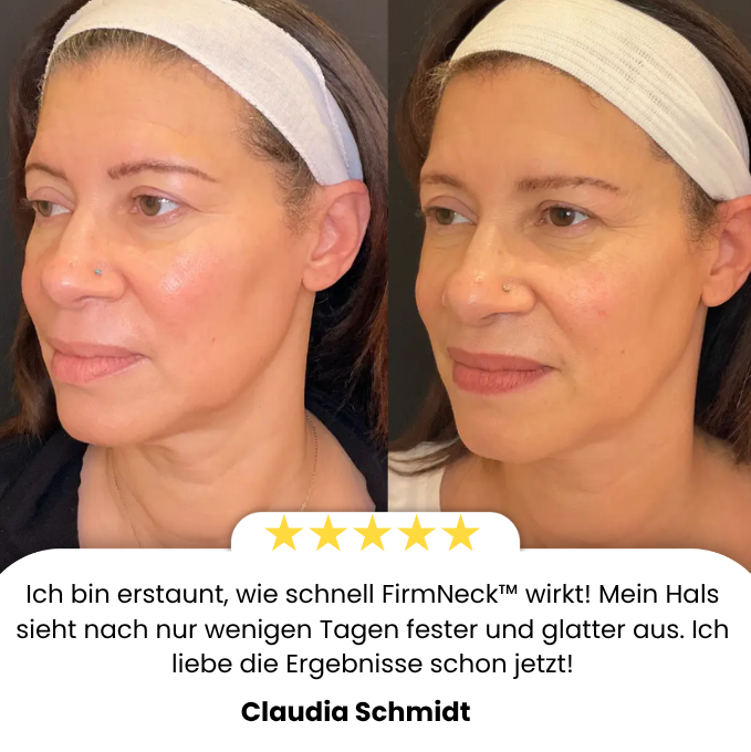 FirmNeck™ | Straffe und hebe deinen Hals in nur 7 Tagen!