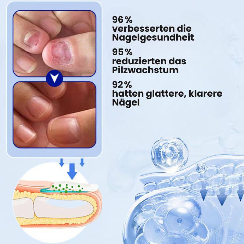 FungiPatch™ Stellen Sie gesunde Nägel ganz einfach wieder her