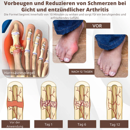 PainShield™ | 95 % Entzündung in 7 Tagen!