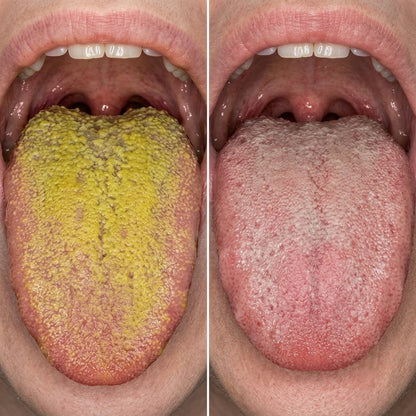 Oraviva™ | Atem- & Darm-Balance-Kapsel