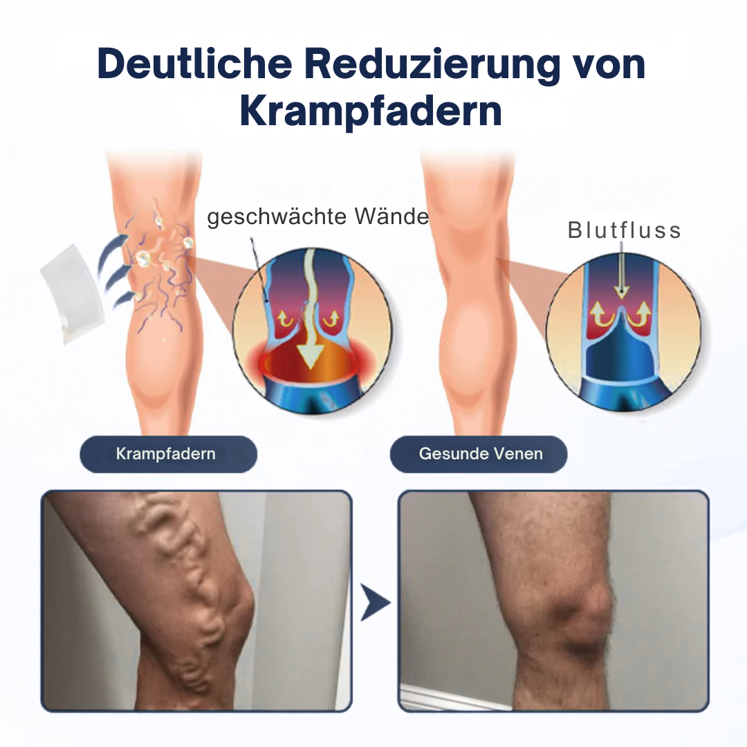 VariEase™ Deep Vein Repair Mikronadel-Pflaster
