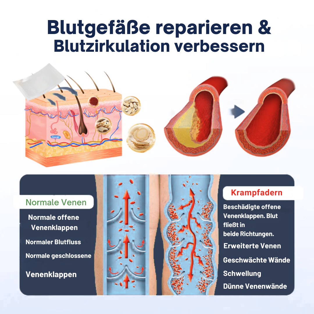 VariEase™ Deep Vein Repair Mikronadel-Pflaster