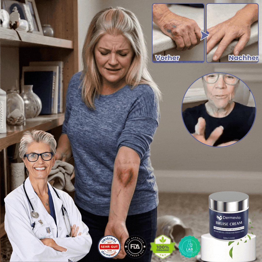 Dermevia™ | Creme gegen blaue Flecken
