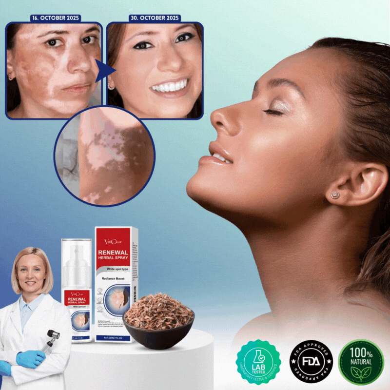 VitiClear™ | Unterstützt 3× schnellere Repigmentierung – sichtbare Ergebnisse in 2 Wochen!