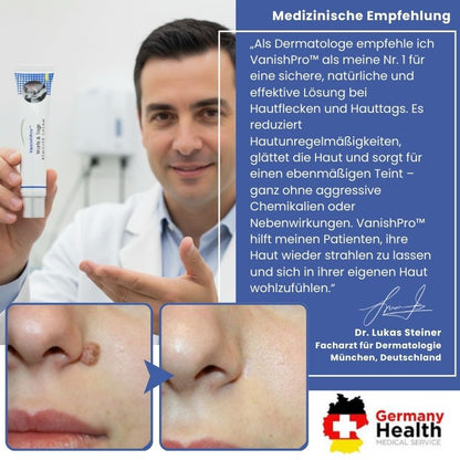 VanishPro™ | Hautpflege zur Entfernung von Hautflecken und Hautanhängseln
